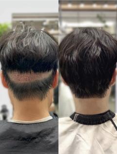 모발.jpg