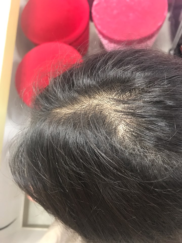 KakaoTalk_20170702_111832257.jpg
