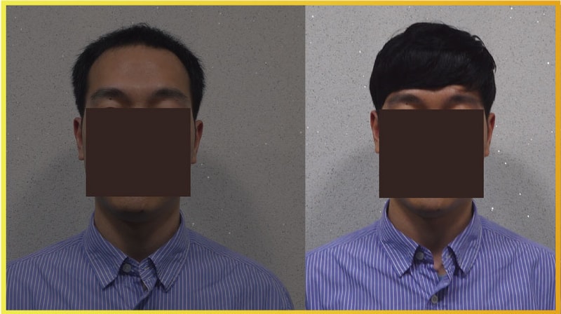 비포애프터2.jpg