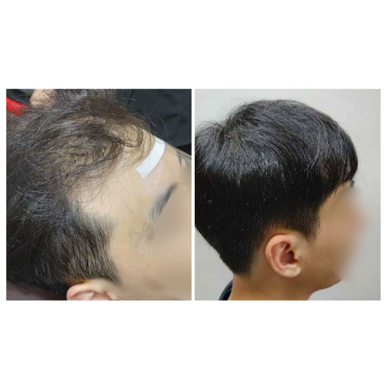 인스타11.jpg