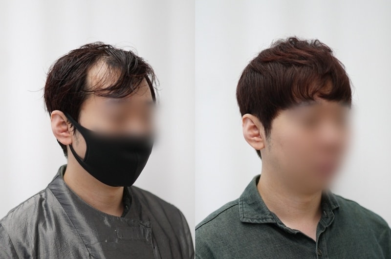 다운로드 2.jpg