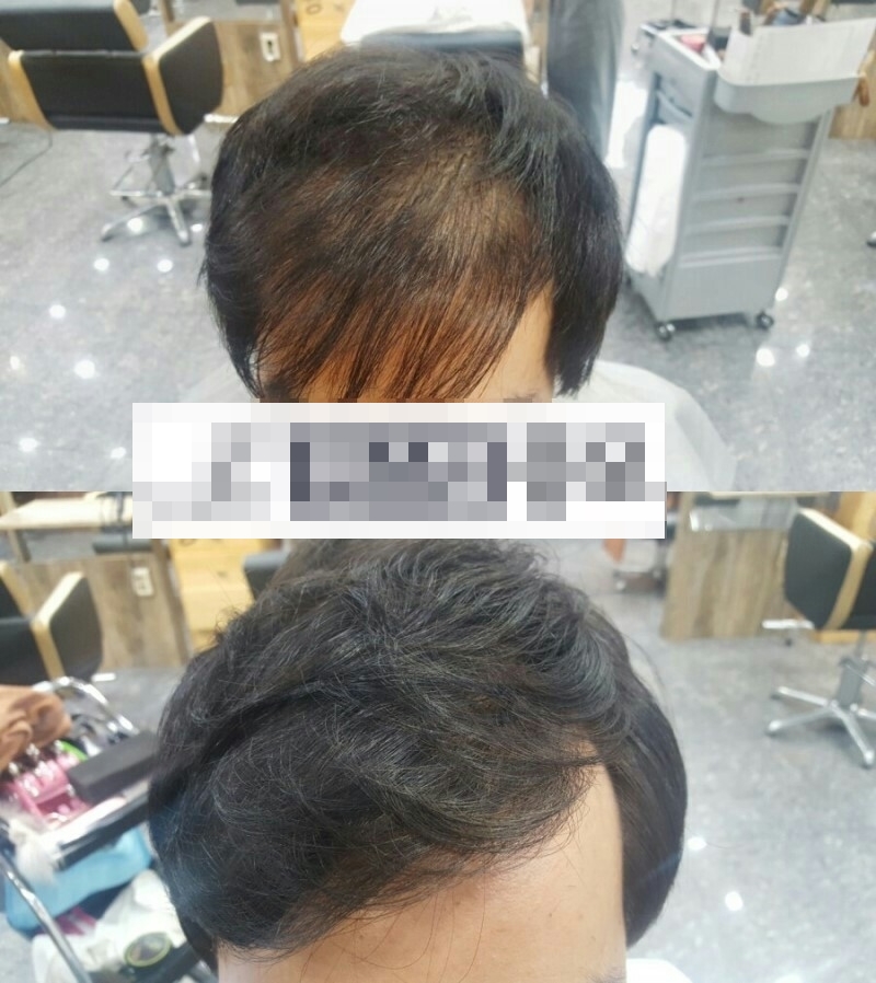 남자앞머리.jpg