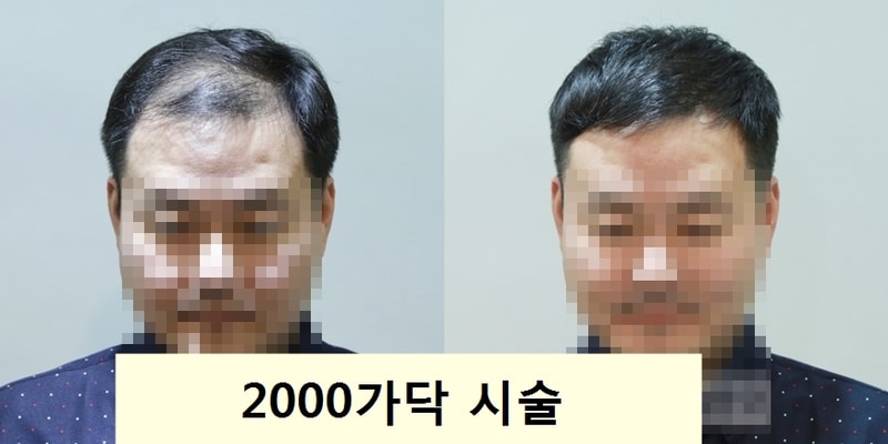2000가닥.jpg