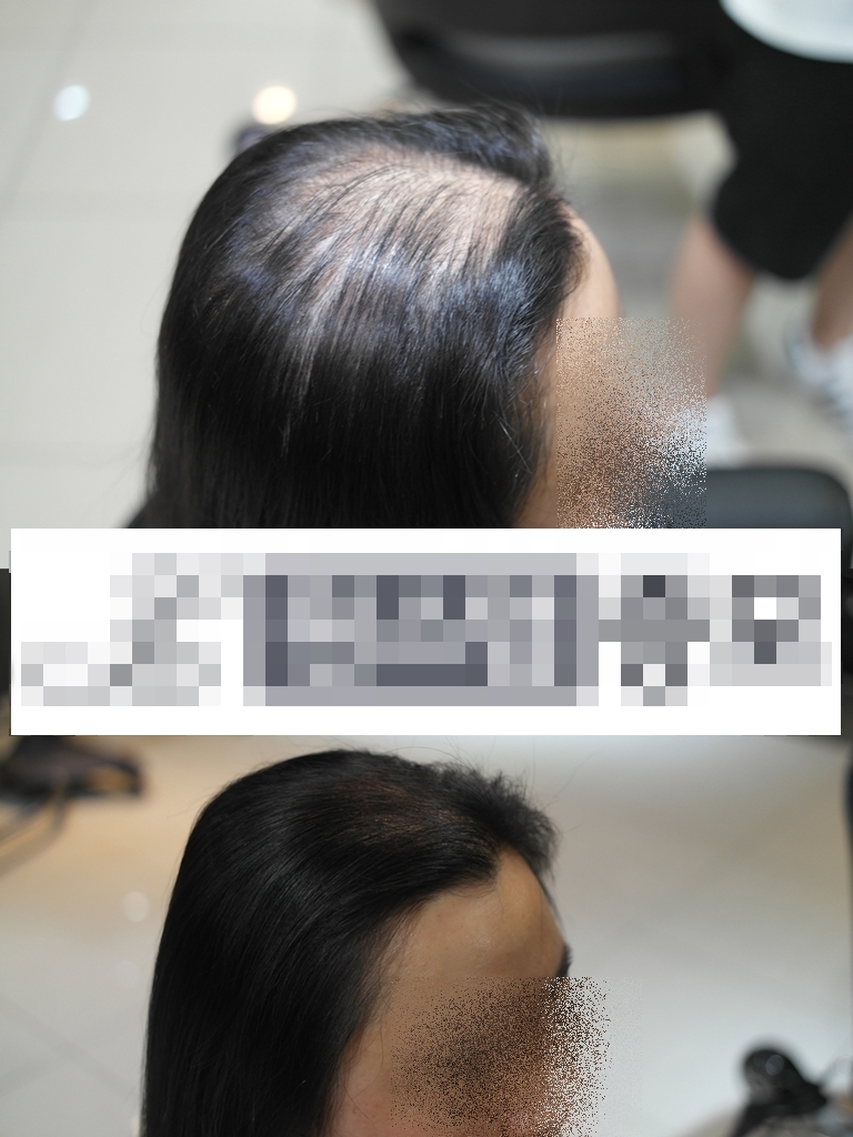 여자증모1.jpg