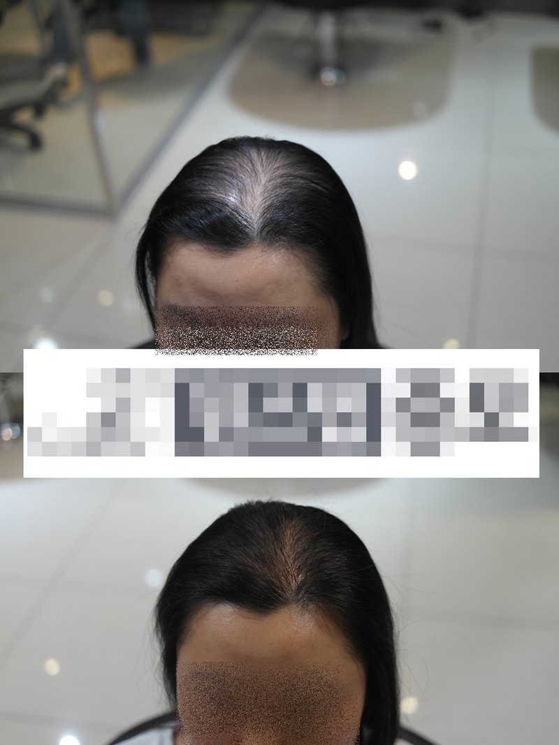 여자증모2.jpg