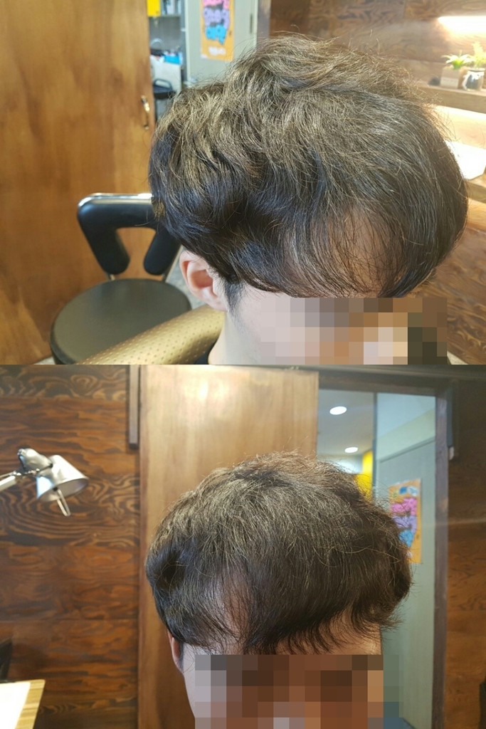 남자앞머리갈라짐500.jpg
