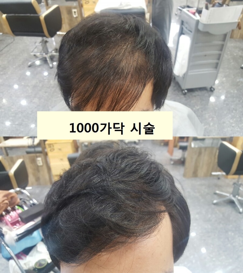 1000-1.jpg