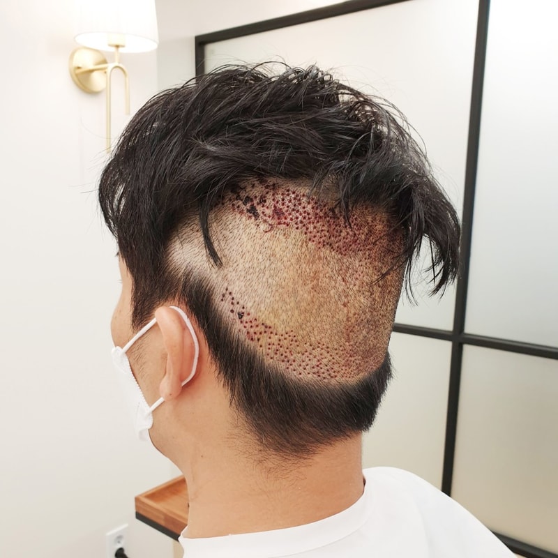 머리숱_없는_남자_15.jpg