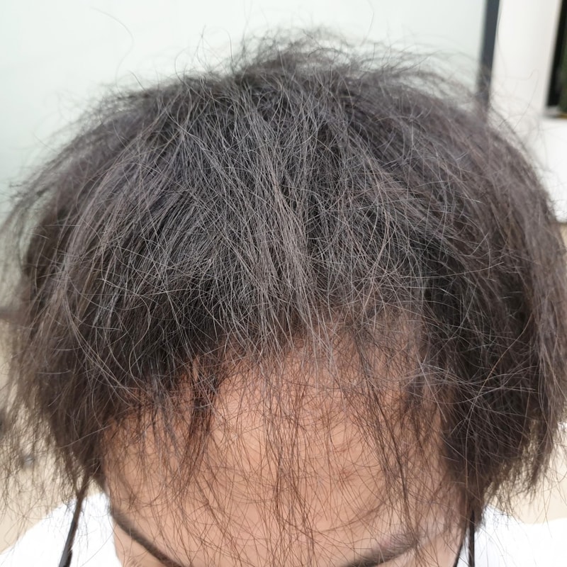 앞머리_갈라짐_25.jpg