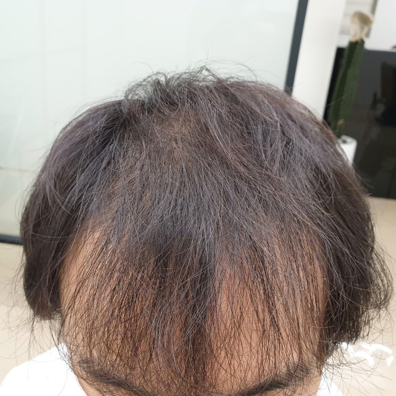 앞머리_갈라짐_15.jpg