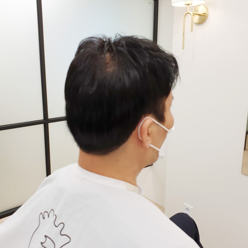 머리숱_없는_남자_1.jpg