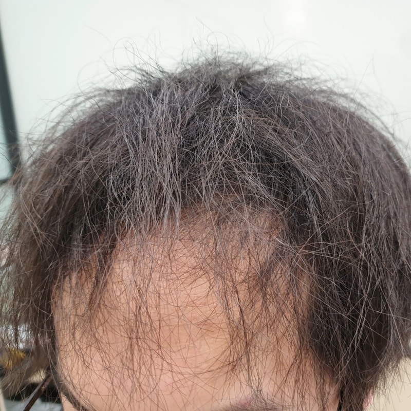 앞머리_갈라짐_27.jpg