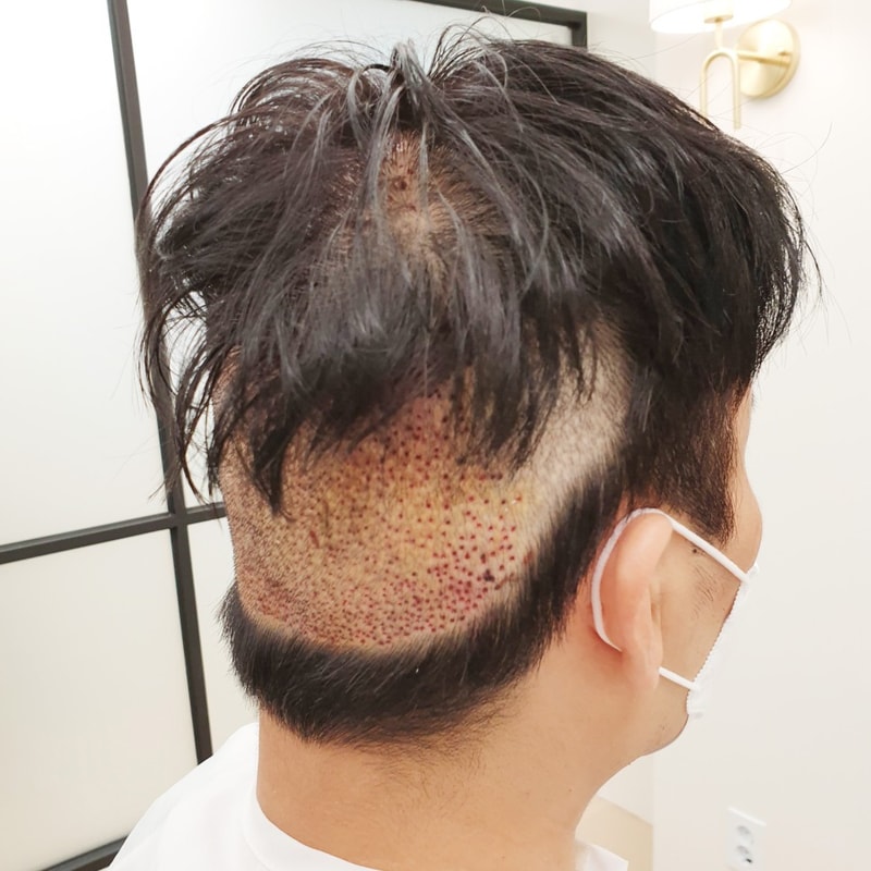 머리숱_없는_남자_13.jpg