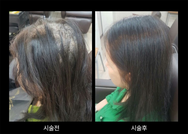 코모리치 1.jpg