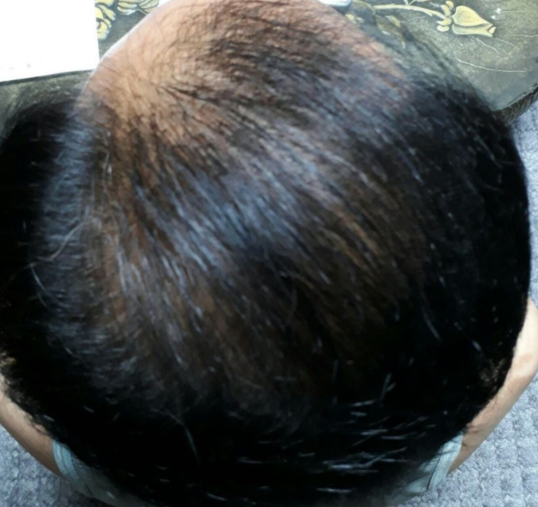 3.PNG