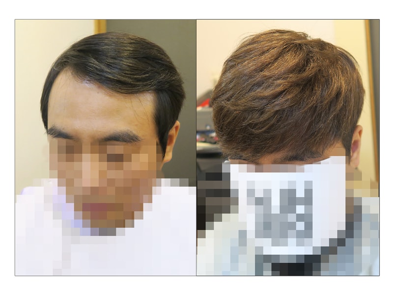 0-0-비포-에프터 사본-1.JPG