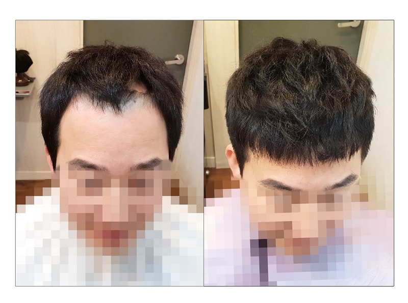 3-윗면.jpg