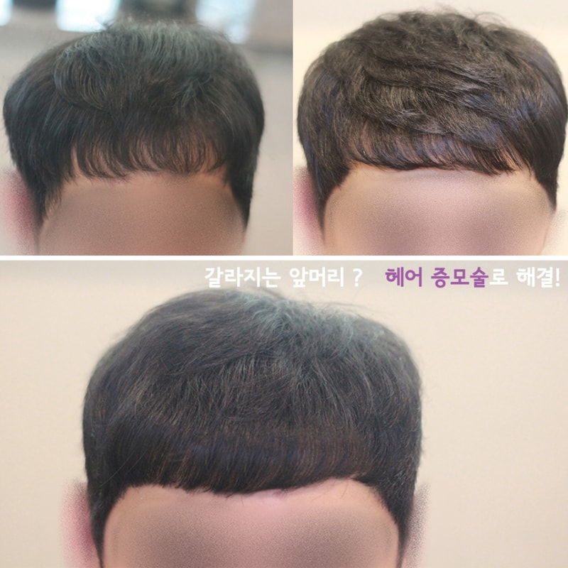 대다모 증모술.jpg