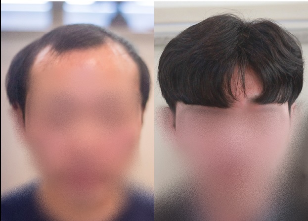 대몽몽1.jpg