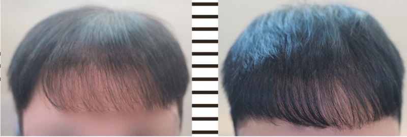 증모1.jpg