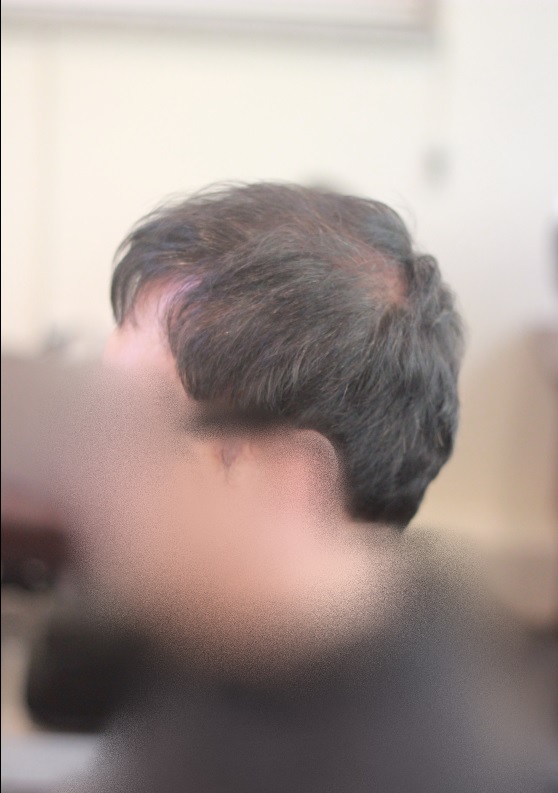 모히칸2.jpg