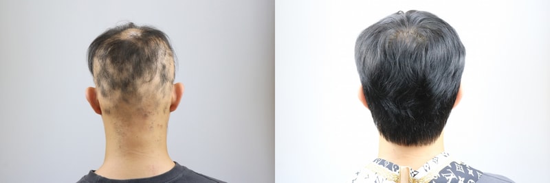 [크기변환]전체가발 5.jpg