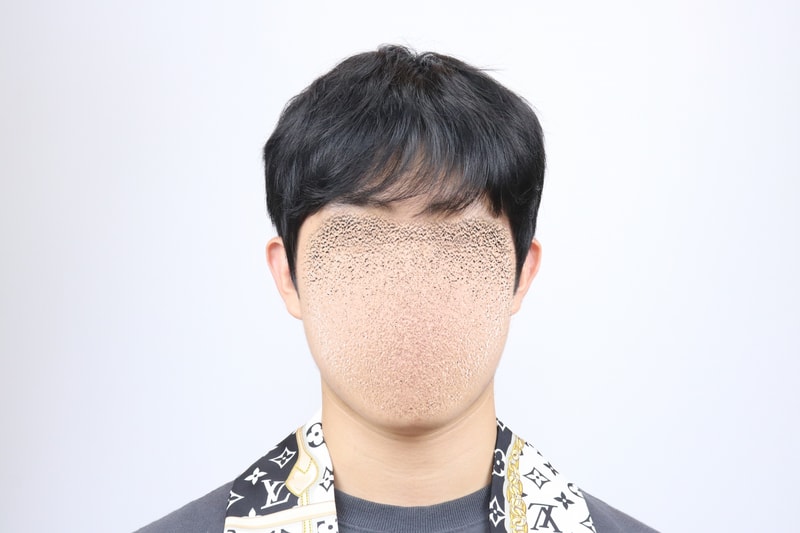 전체가발.jpg