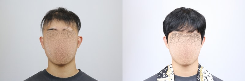 [크기변환]전체가발 1.jpg