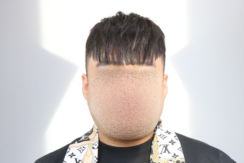 대구가발.jpg