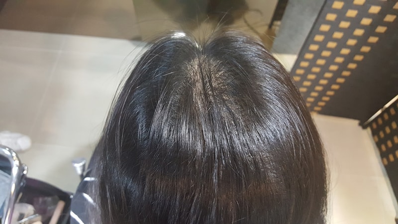 여자정수리2.jpg