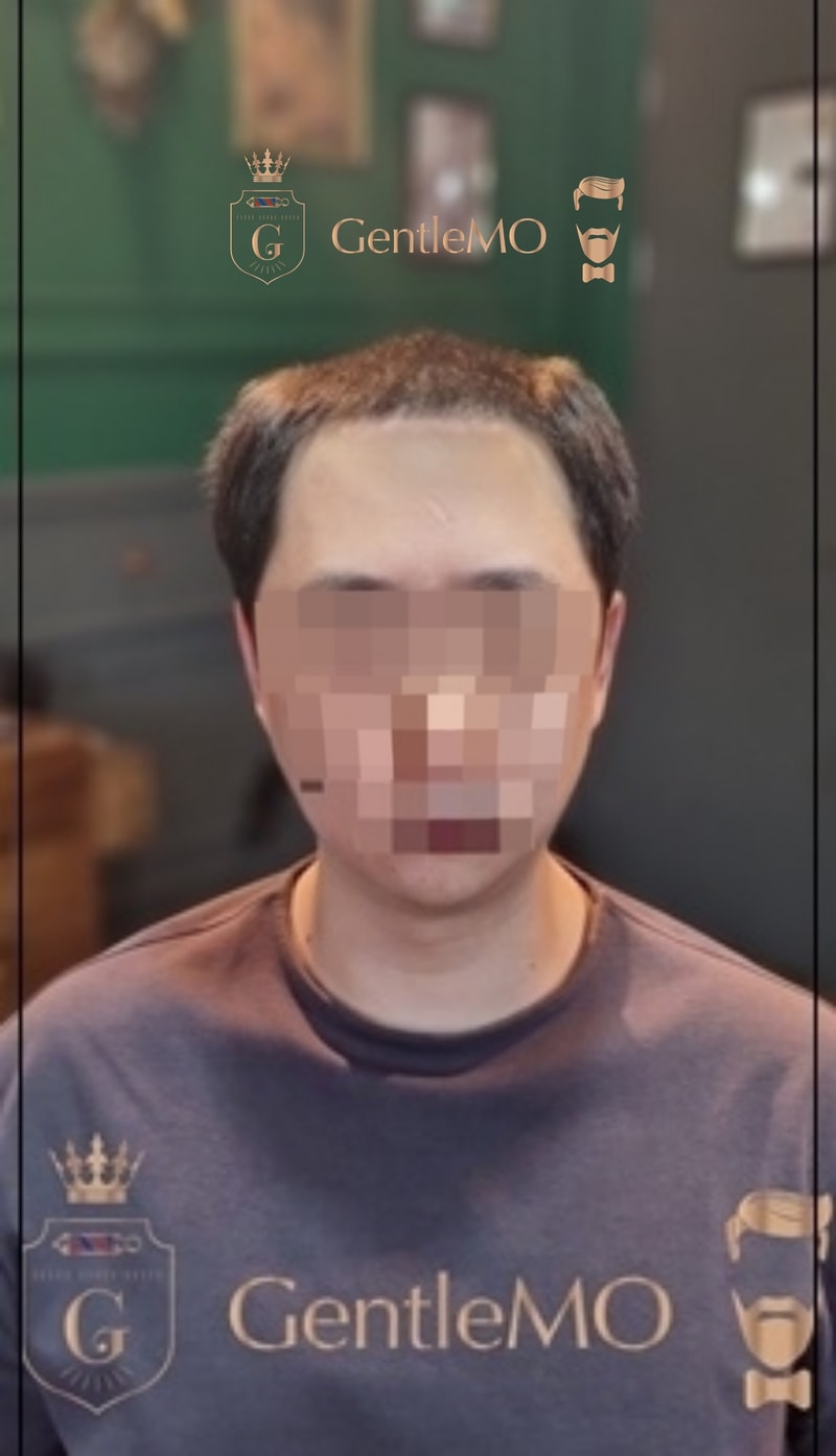 부천가발, 인천가발, 일산가발, 김포가발, 서울가발, 가발수리, 가발증모, 맞춤가발, 남자가발, 하이모디자이너, 전체가발, 가발잘하는곳 남성가발 가발수선26.jpg