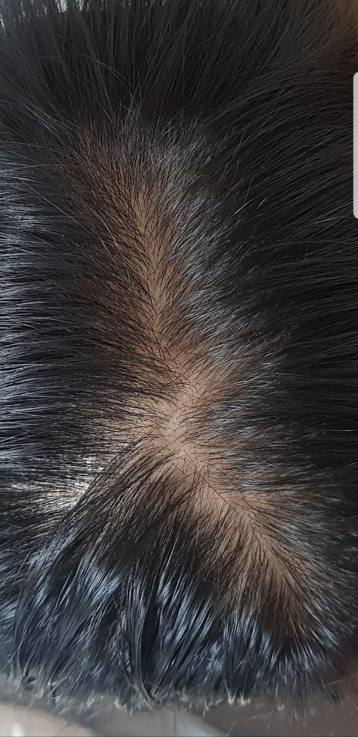 Screenshot_20180723-102515_Gallery.jpg