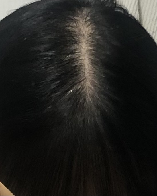 21년에 거울 앞에서 숙이고 찍은 사진