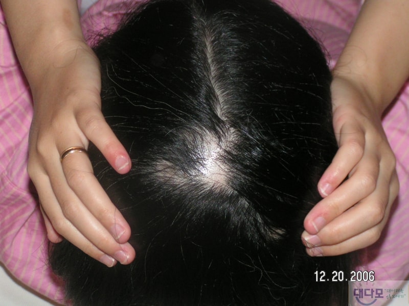 PICT0005.JPG