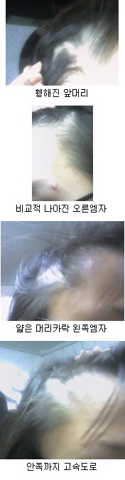 머리상태.jpg