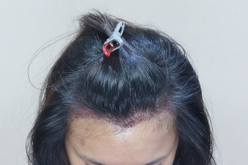 1.JPG