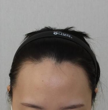 수술 전 2.JPG