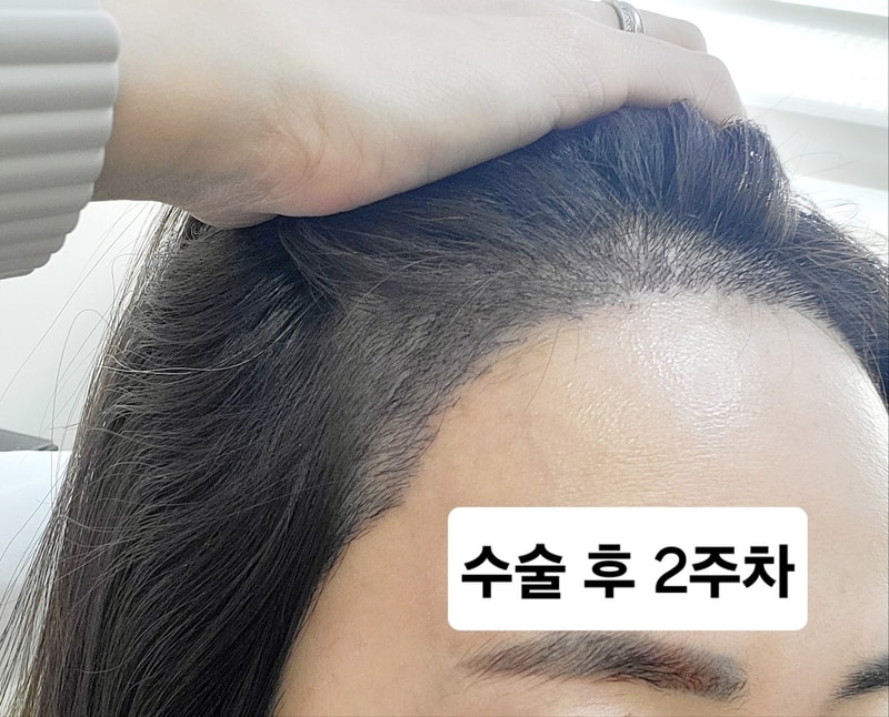 KakaoTalk_20241213_114137502.jpg