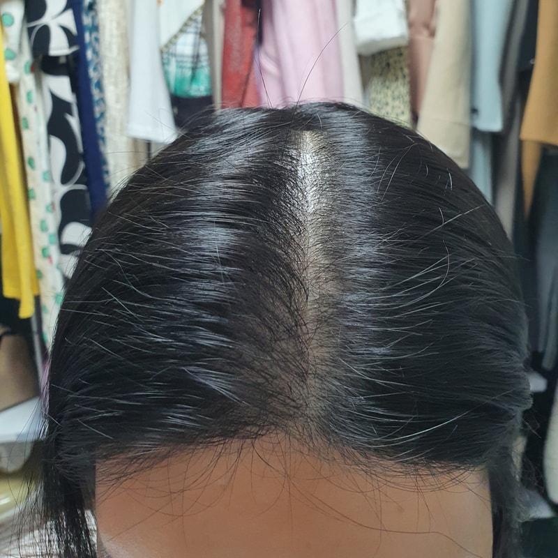 최근 2.jpg