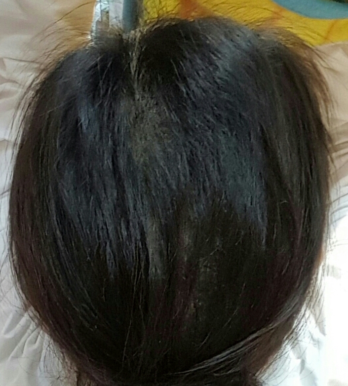 20170309_185931.jpg