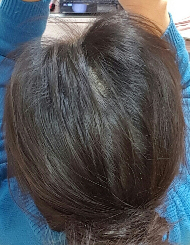 20170309_185907.jpg