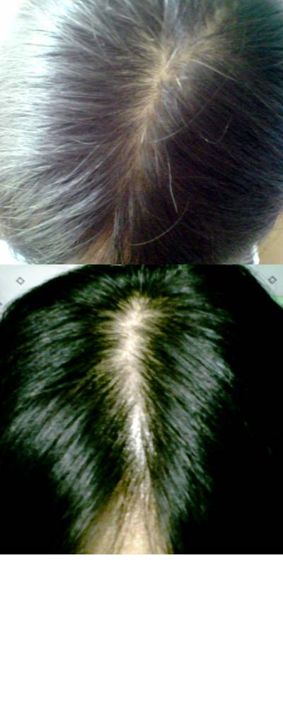 z-hair.jpg