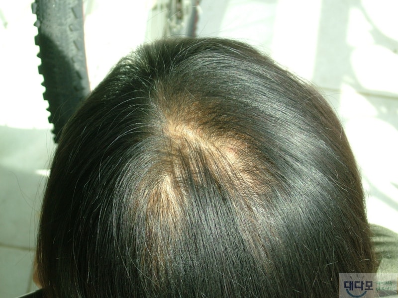 2010040211.JPG
