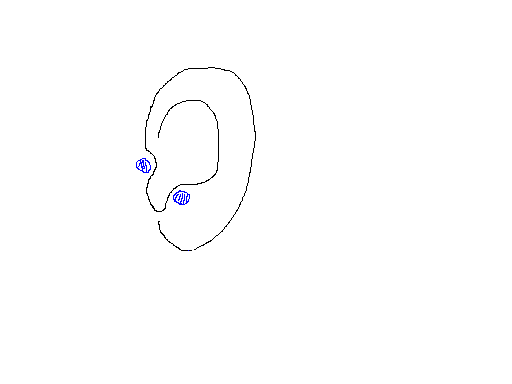 귀마사지_2.bmp