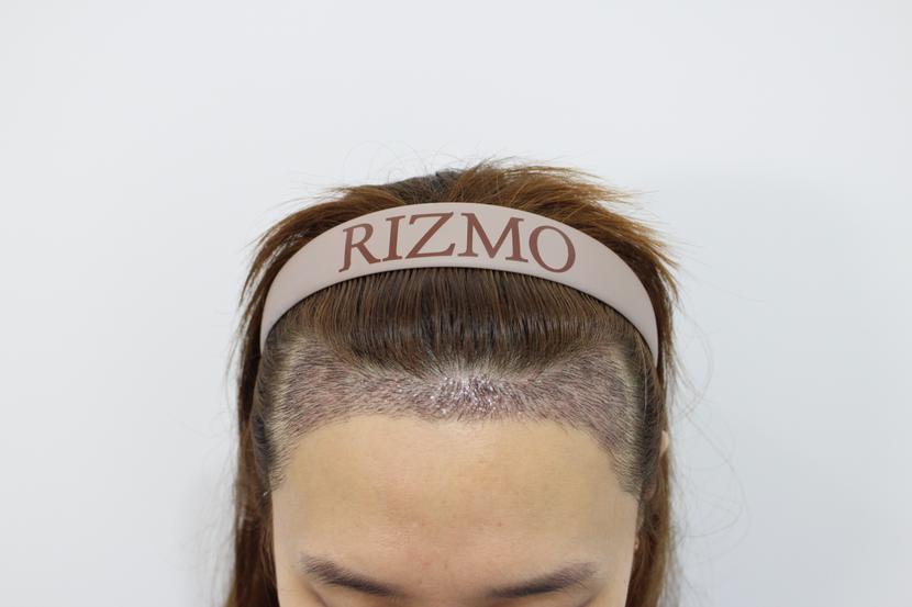 32d77864db6cfc8069b3868e7a9ee7e7_1721533674_518.jpg 32d77864db6cfc8069b3868e7a9ee7e7_1721533674_518.jpg