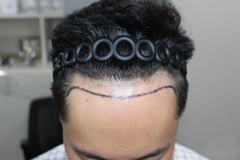 76171dfc35a1bee0087a825801c5ea09_1747038346_9175.jpg 76171dfc35a1bee0087a825801c5ea09_1747038346_9175.jpg