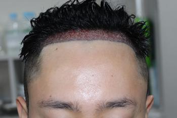 76171dfc35a1bee0087a825801c5ea09_1747038357_8859.jpg 76171dfc35a1bee0087a825801c5ea09_1747038357_8859.jpg