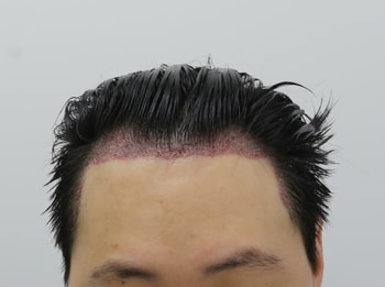 aab735fd2c4e3e5084d06d94325e7533_1750302184_2413.jpg aab735fd2c4e3e5084d06d94325e7533_1750302184_2413.jpg