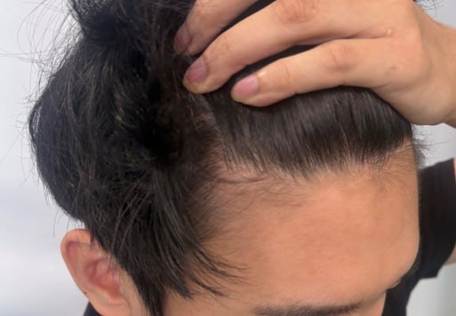 5793b4abfd28e4a0f94605130bee9468_1760595689_7951.jpg 5793b4abfd28e4a0f94605130bee9468_1760595689_7951.jpg