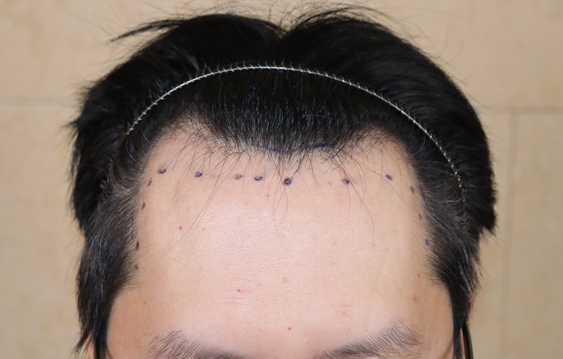 포토후기 이미지